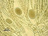 Leathesia mucosa var. mucosa2